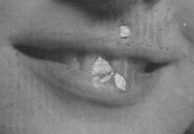 photo retouch